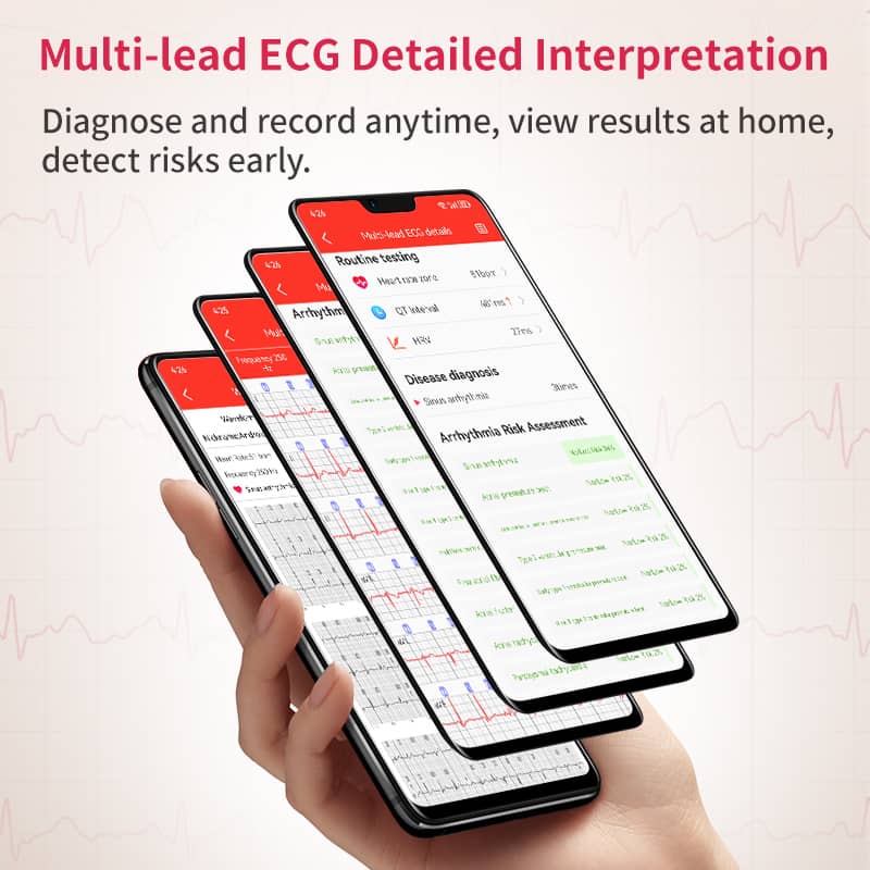 MULTI-Lead ECG Monitoring  Blood Glucose Blood Pressure Heart Rate Measurement Health Smart Watch